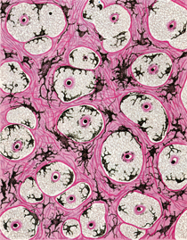 Células negras (melanóforos) de la piel de un conejo. Dibujo de Pío del Río-Hortega, publicado en la revista Residencia, 1933. Residencia de Estudiantes, Madrid