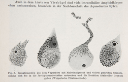 Gonzalo Rodríguez Lafora, «Beitrag zur Histopatologie der myclonischen Epilepsie», Zeitschrift für die Gesamte Neurologie und Psychiatrie, Berlín, vol. 6, fasc. 1, 1919