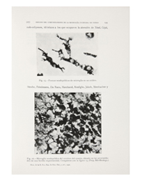 Isaac Costero Tudanca, «Estudio del comportamiento de la microglía cultivada “in vitro”. Datos concernientes a su histogénesis», Memorias de la Real Sociedad Española de Historia Natural, tomo xiv, núm. 87, Madrid Isaac Costero Tudanca, «Estudio del comportamiento de la microglía cultivada “in vitro”. Datos concernientes a su histogénesis», Memorias de la Real Sociedad Española de Historia Natural, tomo xiv, núm. 87, Madrid